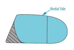 Correct for In-Toe