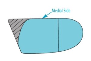Correct for Out-Toe