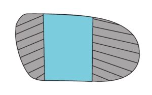 Extrinsic Forefoot and Rearfoot Posting