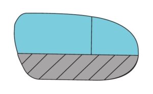 Lateral Wedge