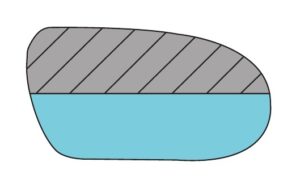 Medial Wedge