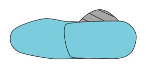 Navicular Flap