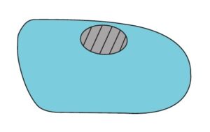 Navicular Shell Acommodation