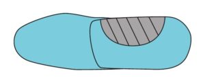 Scaphoid Pad