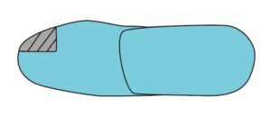 Toe Filler; Single Digit or Transmet Filler