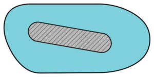 Plantar Fascial Groove